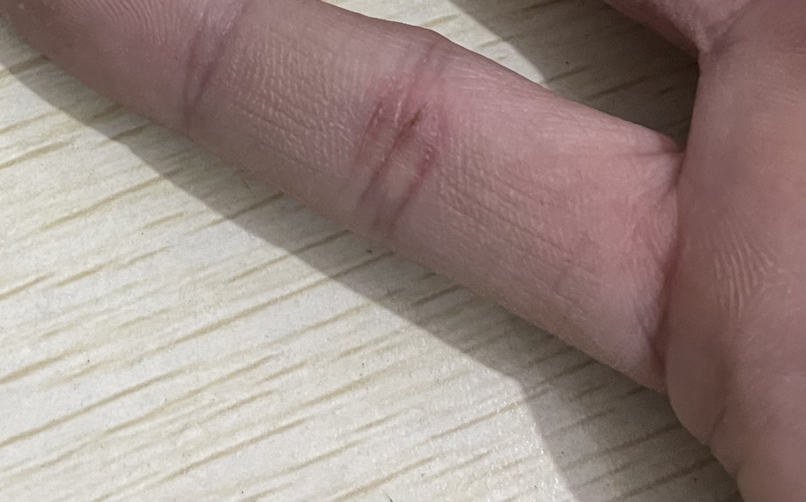 顺丰快递包裹含有铁钉，损坏运送手机并扎破收件人手指